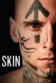 VER Skin (2018) Online Gratis HD